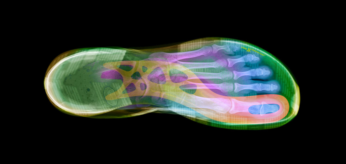 X-ray of a foot inside a Joe Nimble running shoe
