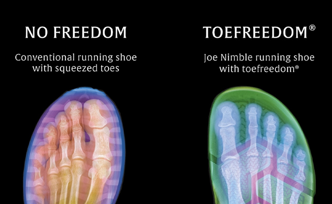 We call it toefreedom®