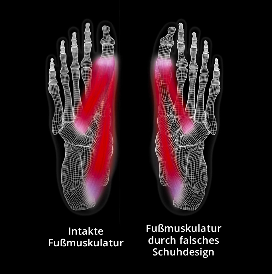 Röntgenvideo eines Fußes und dessen Muskulatur mit Zehenfreiheit und ohne Zehenfreiheit